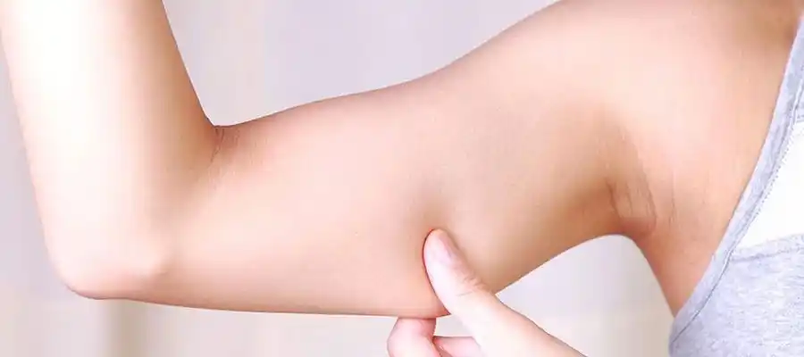 ameliyatsız kol germe