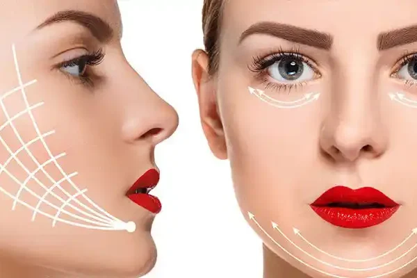 orumcek-agi-estetigi