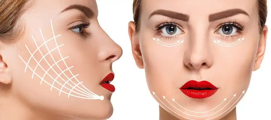 örümcek ağı estetiği