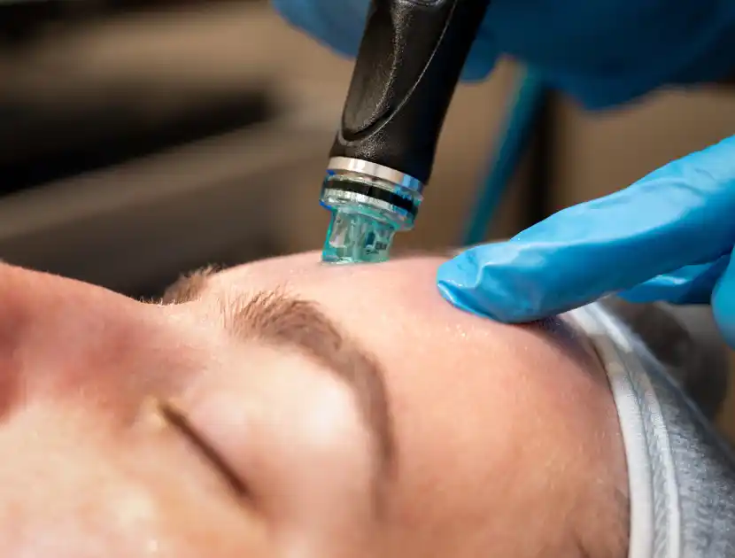 Hydrafacial 1 Hydrafacial