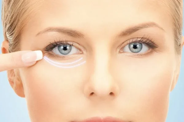 göz cevresi mezoterapisi