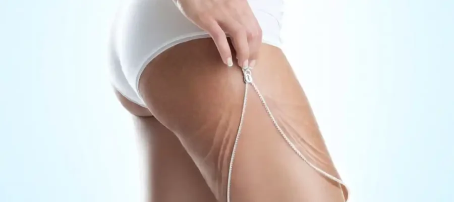 LPG ile Selülit Tedavisi